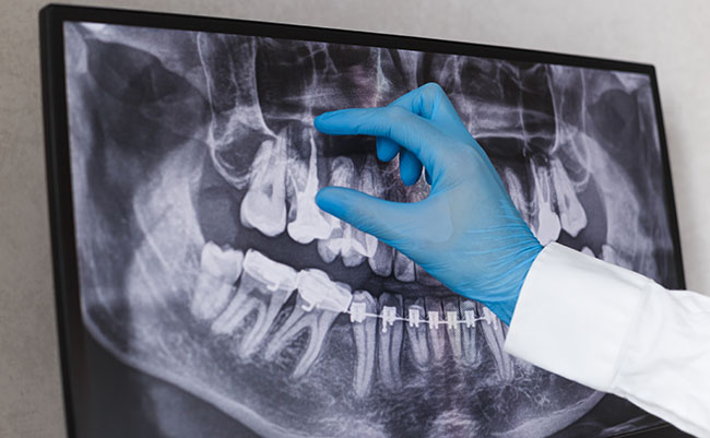 Diagnostic Dental X-Ray