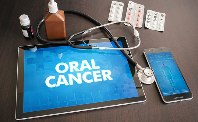 Oral Cancer Screening