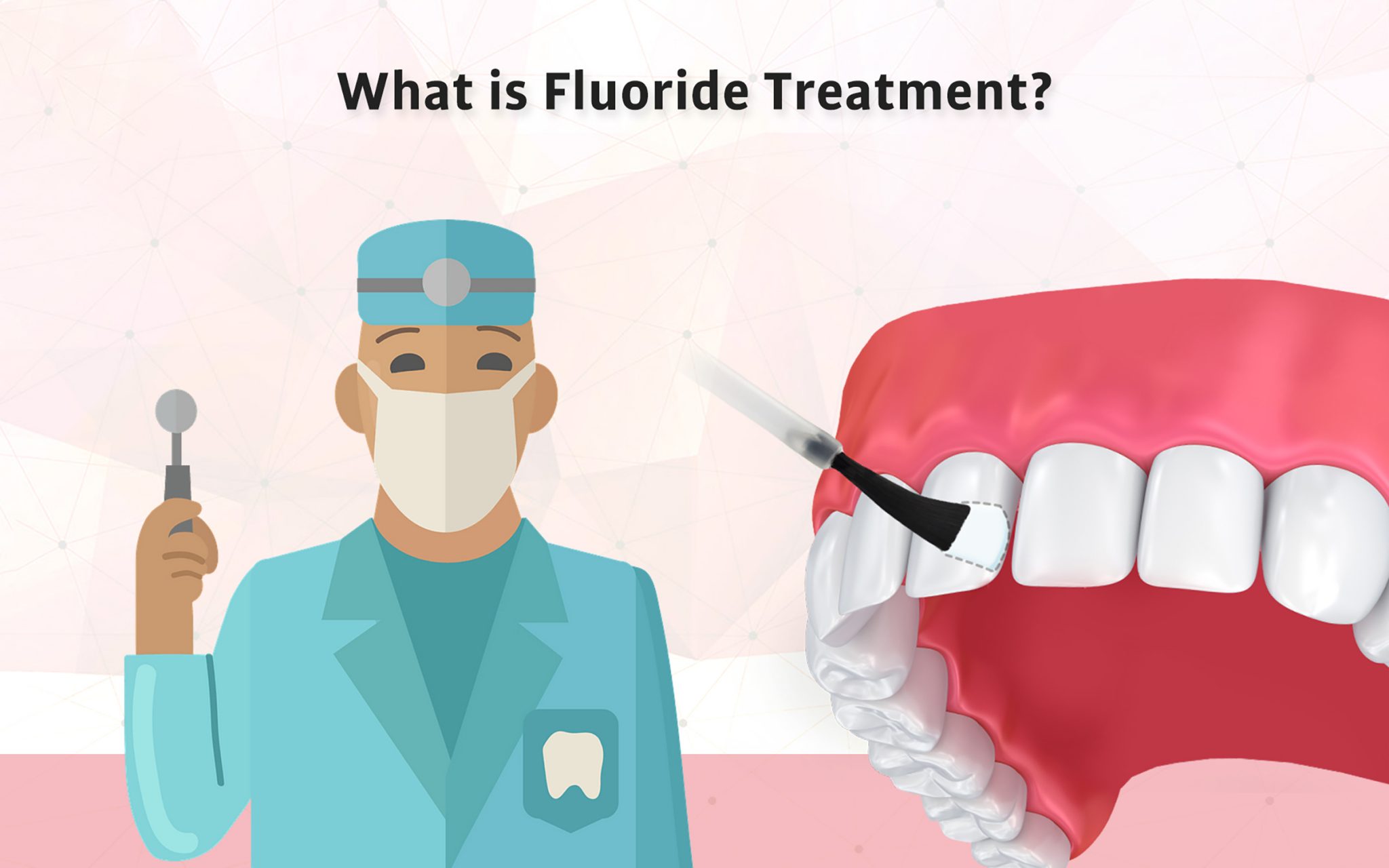 Fluoride Treatments – Family Dental Practice